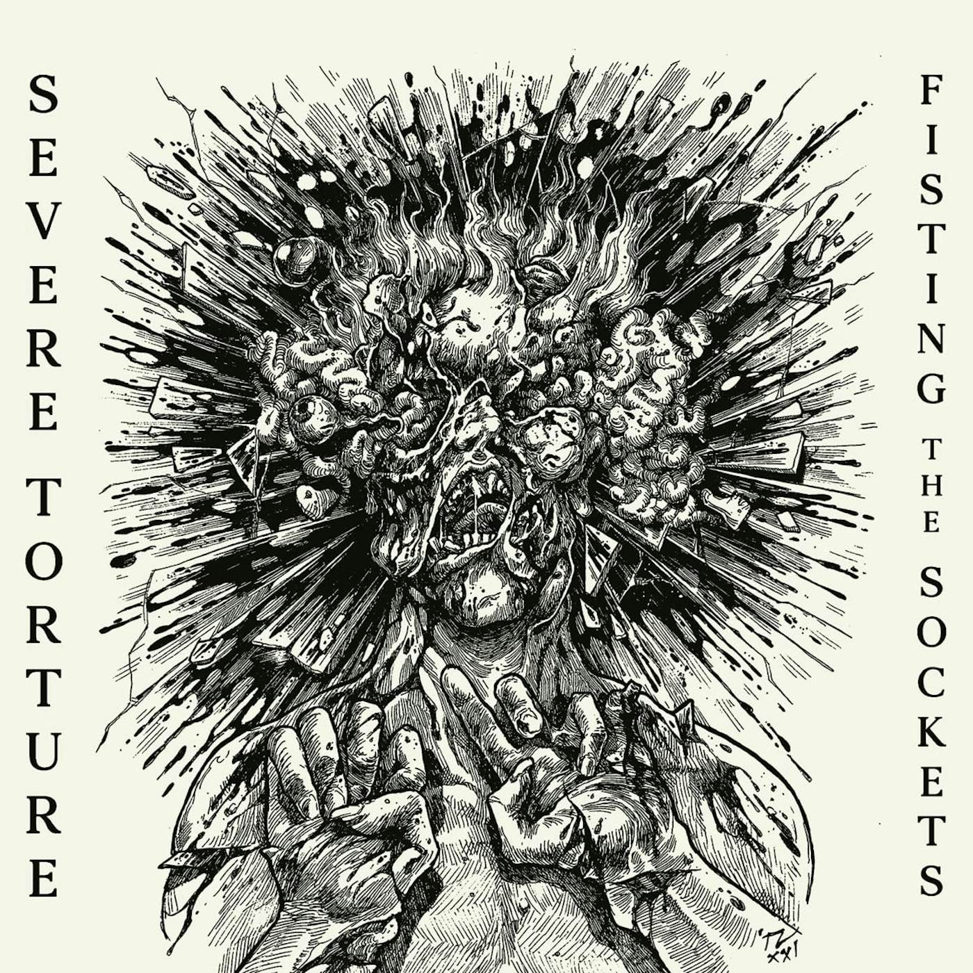 Severe Torture FISTING THE SOCKETS CD
